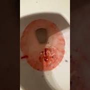 Le texte musical I'LL COUNT TO FOUR de LOVE ME ELECTRIC est également présent dans l'album Medicine and magic ep (2006)